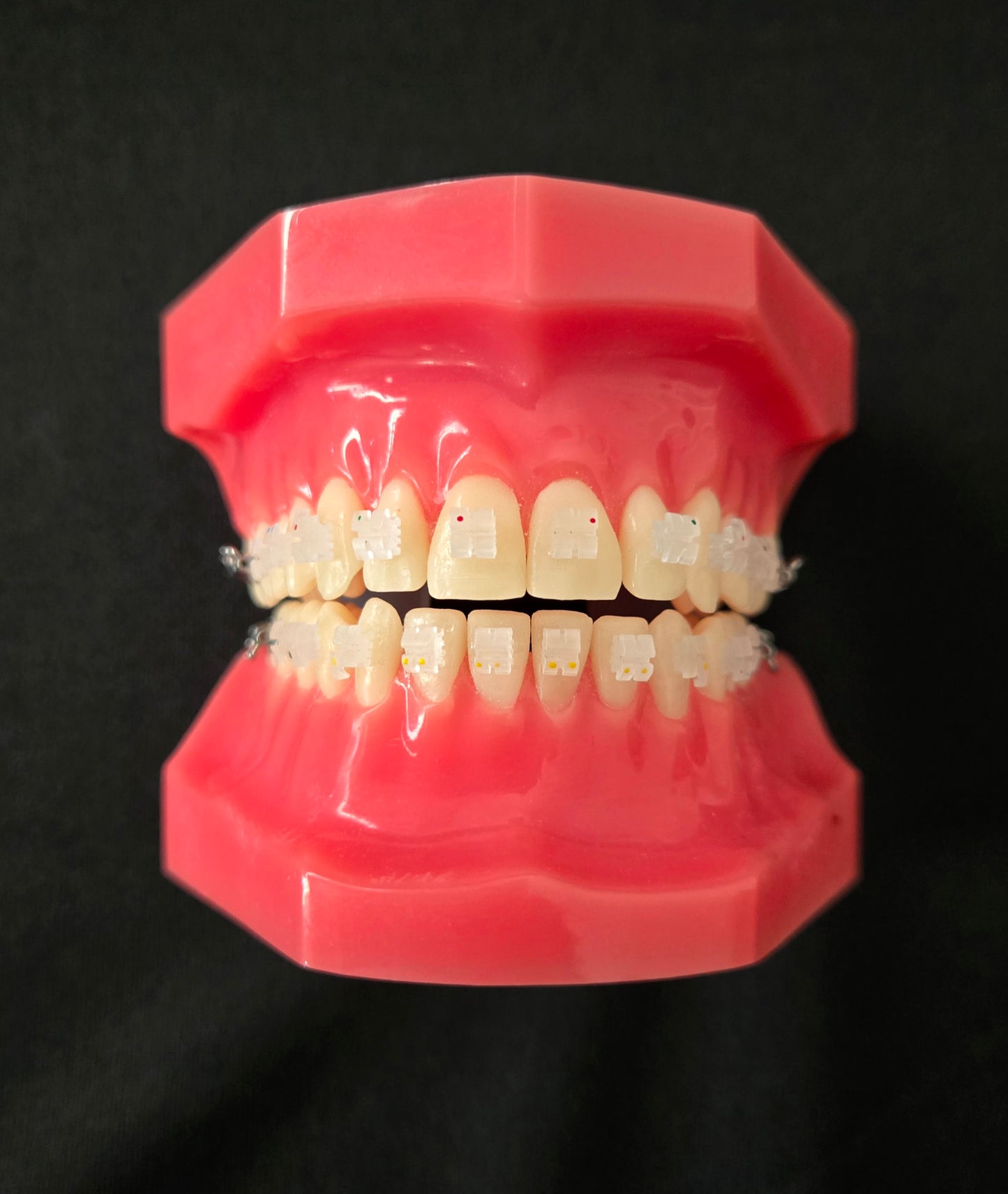 Cx Ceramic .018 Roth Brackets Hooks 3,4,5's