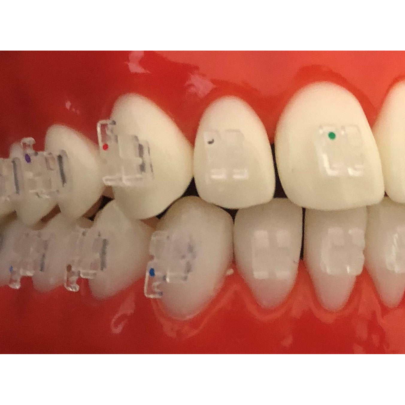 Cx Clear .022 Roth MonoCrystalline Brackets Hooks 3,4,5's