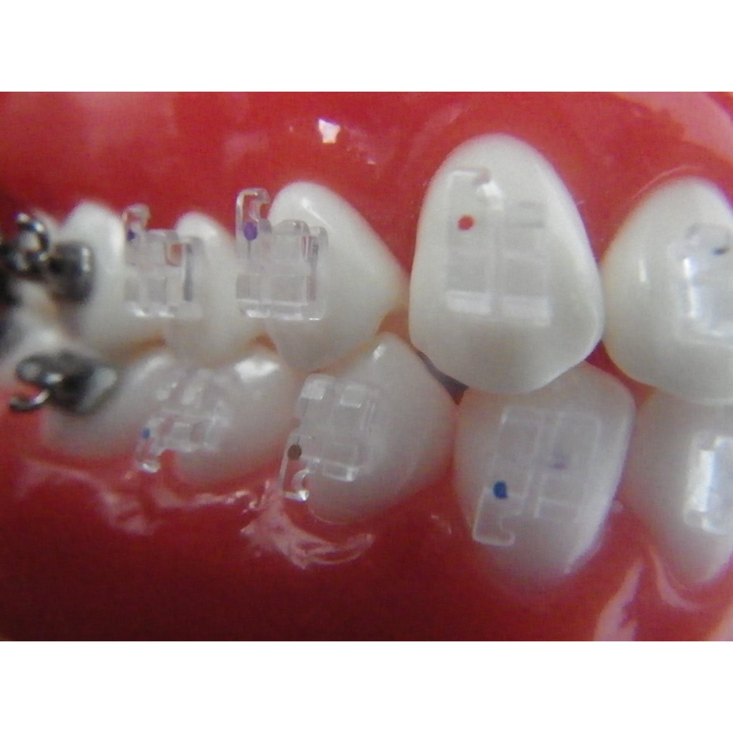 Cx Clear Individual Monocrystalline Brackets- MBT .022 (set of 5)