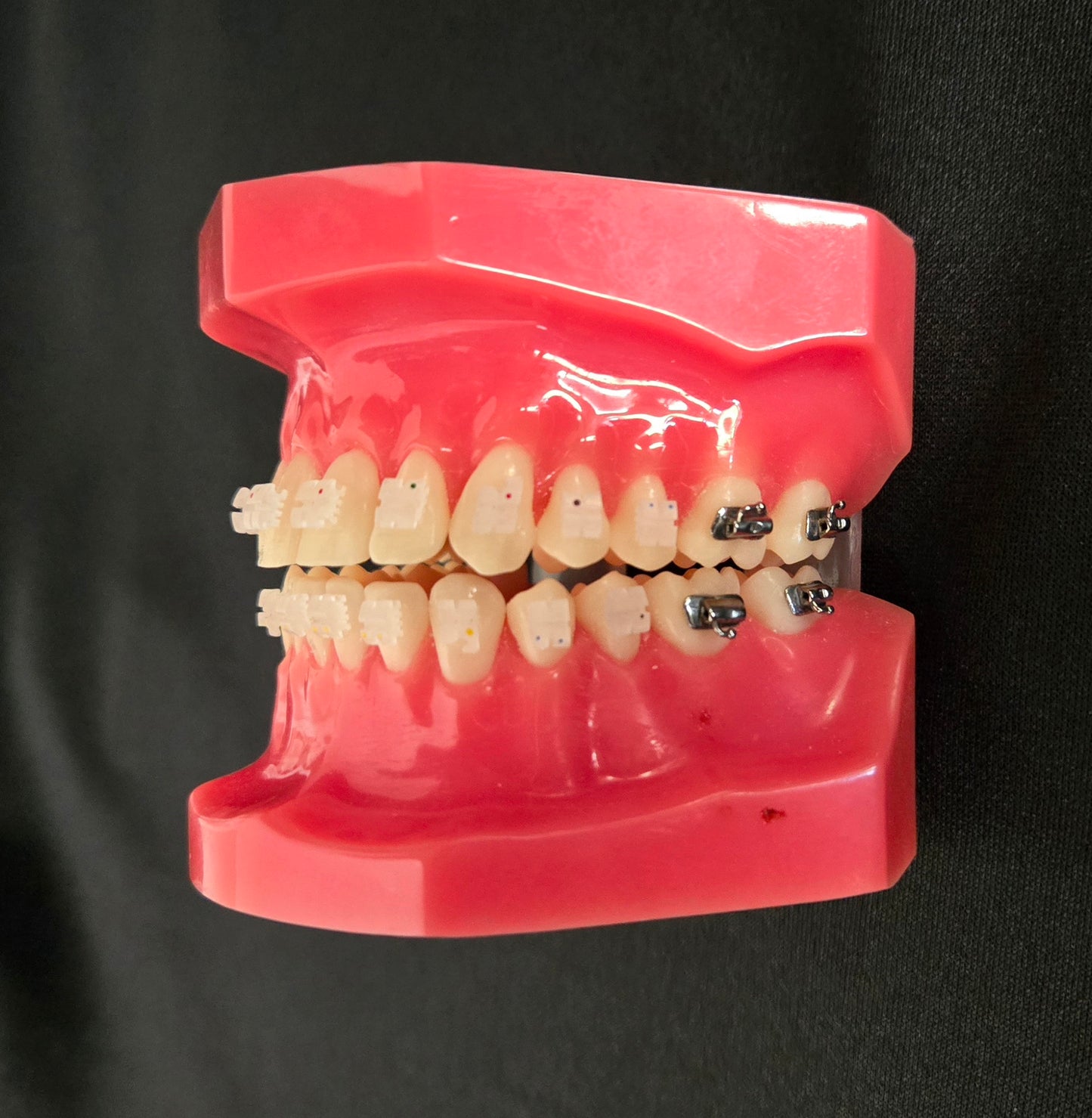 Cx Ceramic .022 MBT Brackets Hooks 3,4,5's