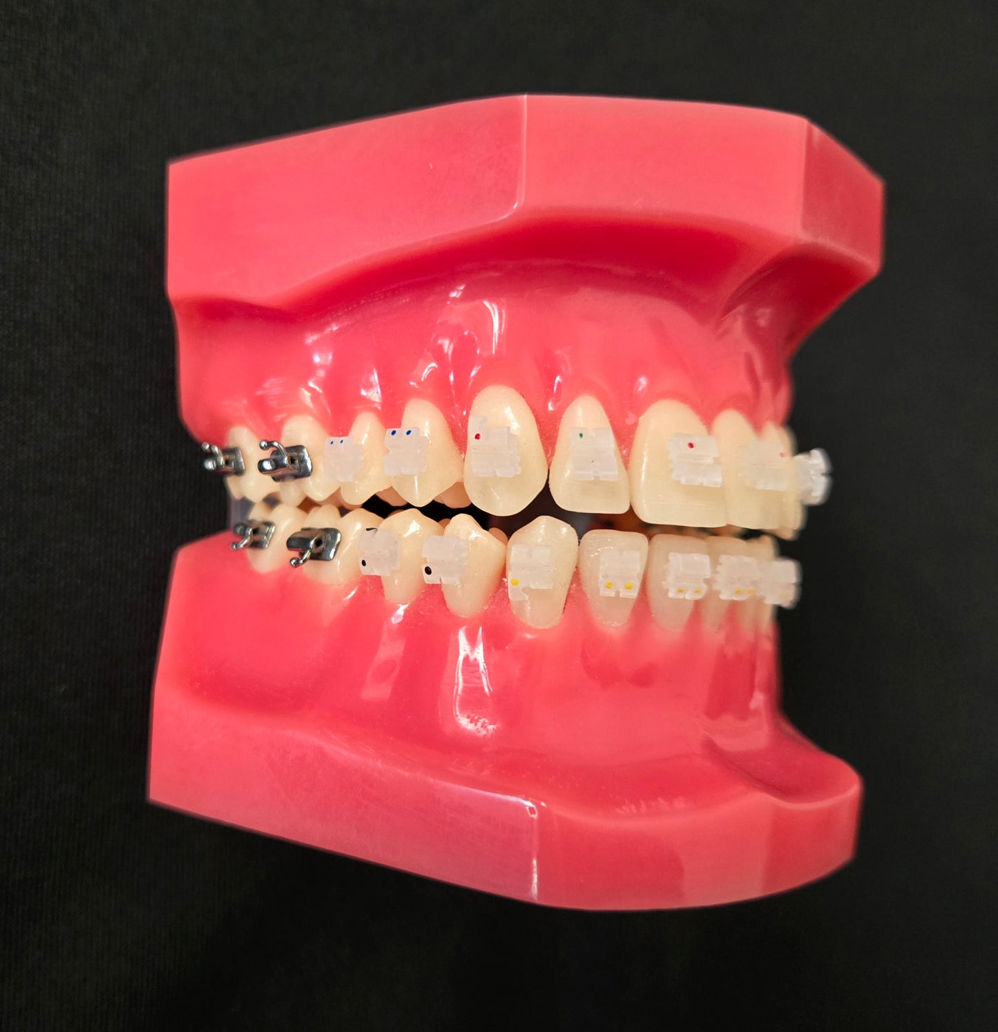 Cx Ceramic .022 MBT Brackets Hooks 3,4,5's